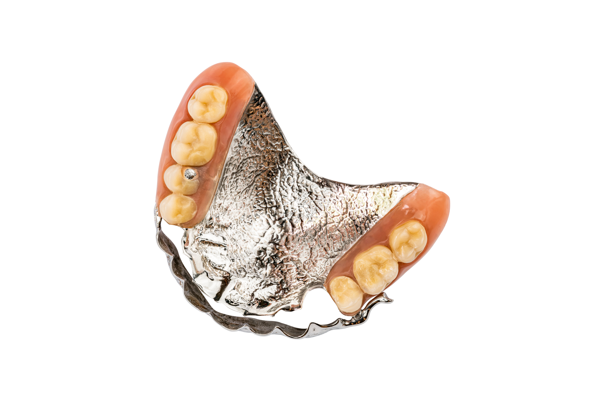 Top view of partial metal removable swinglock denture on white background with clipping path.